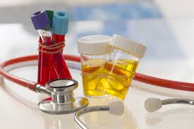 All Types of Blood & Urine Tests