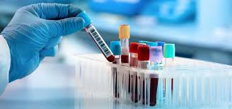 Specialty Diagnostic Panels